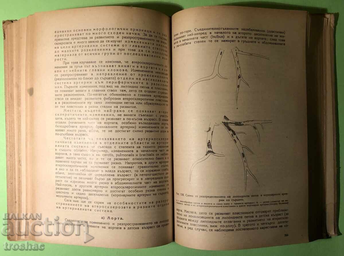 Old Book Private Pathological Anatomy Heart and Blood Vessels C - 6 Old Book Private Pathological Anatomy Heart and Blood Vessels C - 6