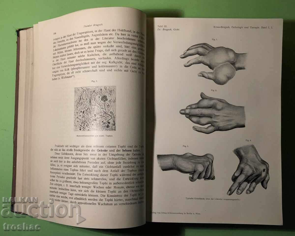 Доставка на Стара Книга Болести на Обмяната Болести на Жлезите с Вътрешн Доставка на Стара Книга Болести на Обмяната Болести на Жлезите с Вътрешн