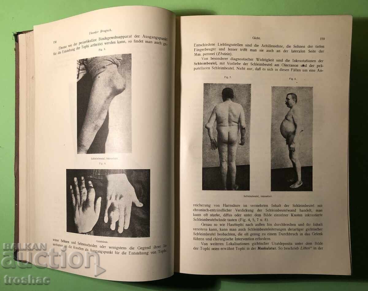 Cartea Veche Boli ale metabolismului Boli ale glandelor cu interne - 5