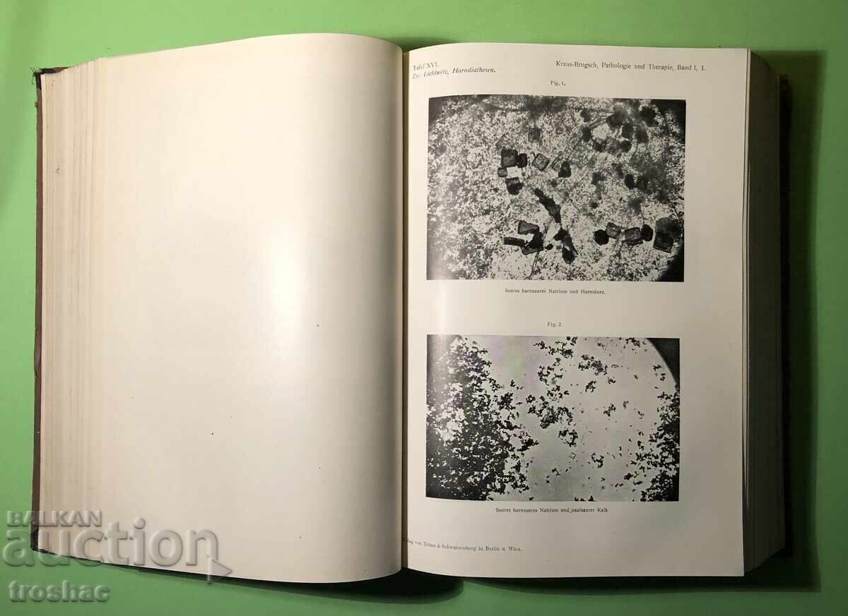 Стара Книга Болести на Обмяната Болести на Жлезите с Вътрешн - 6 Стара Книга Болести на Обмяната Болести на Жлезите с Вътрешн - 6