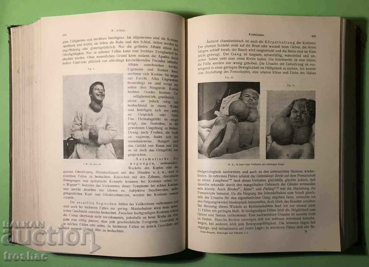 Стара Книга Болести на Обмяната Болести на Жлезите с Вътрешн - 7 Стара Книга Болести на Обмяната Болести на Жлезите с Вътрешн - 7