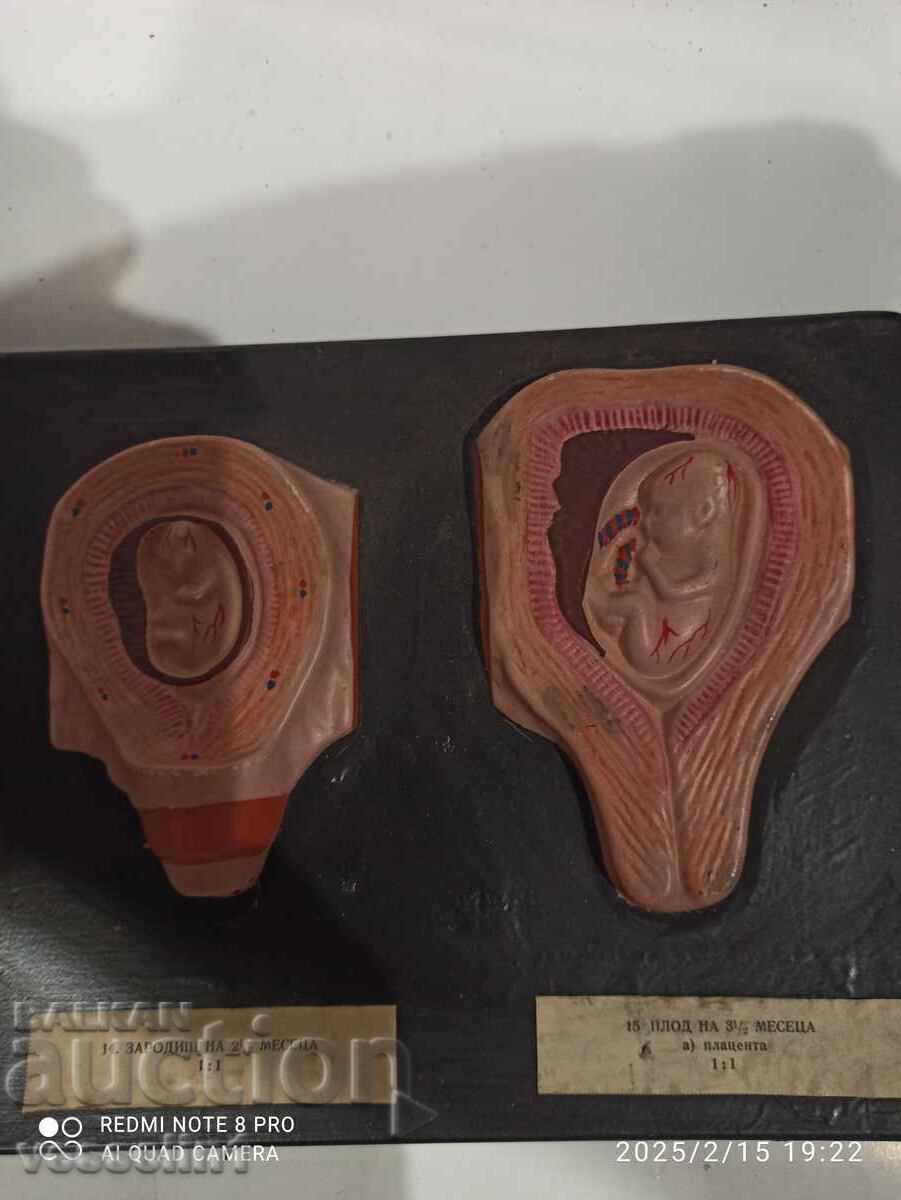 Model of human embryo. Model development from embryo to fetus with price 50.00 BGN | € 25.56