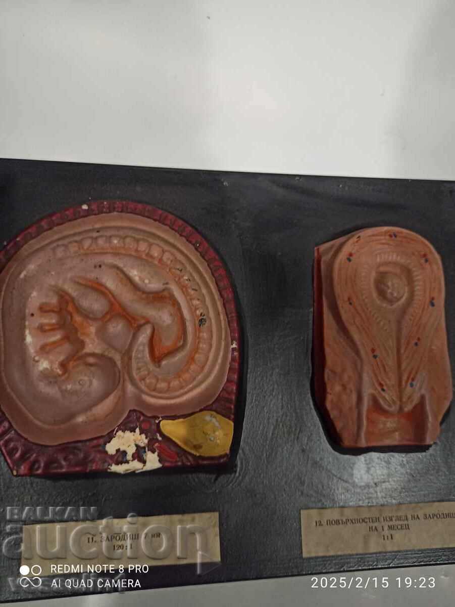 Auction  Model of human embryo. Model development from embryo to fetus