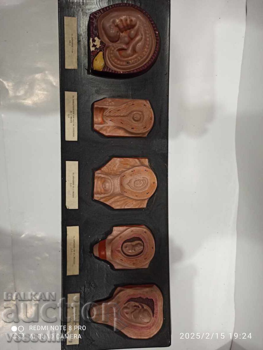 Delivery of Model of human embryo. Model development from embryo to fetus