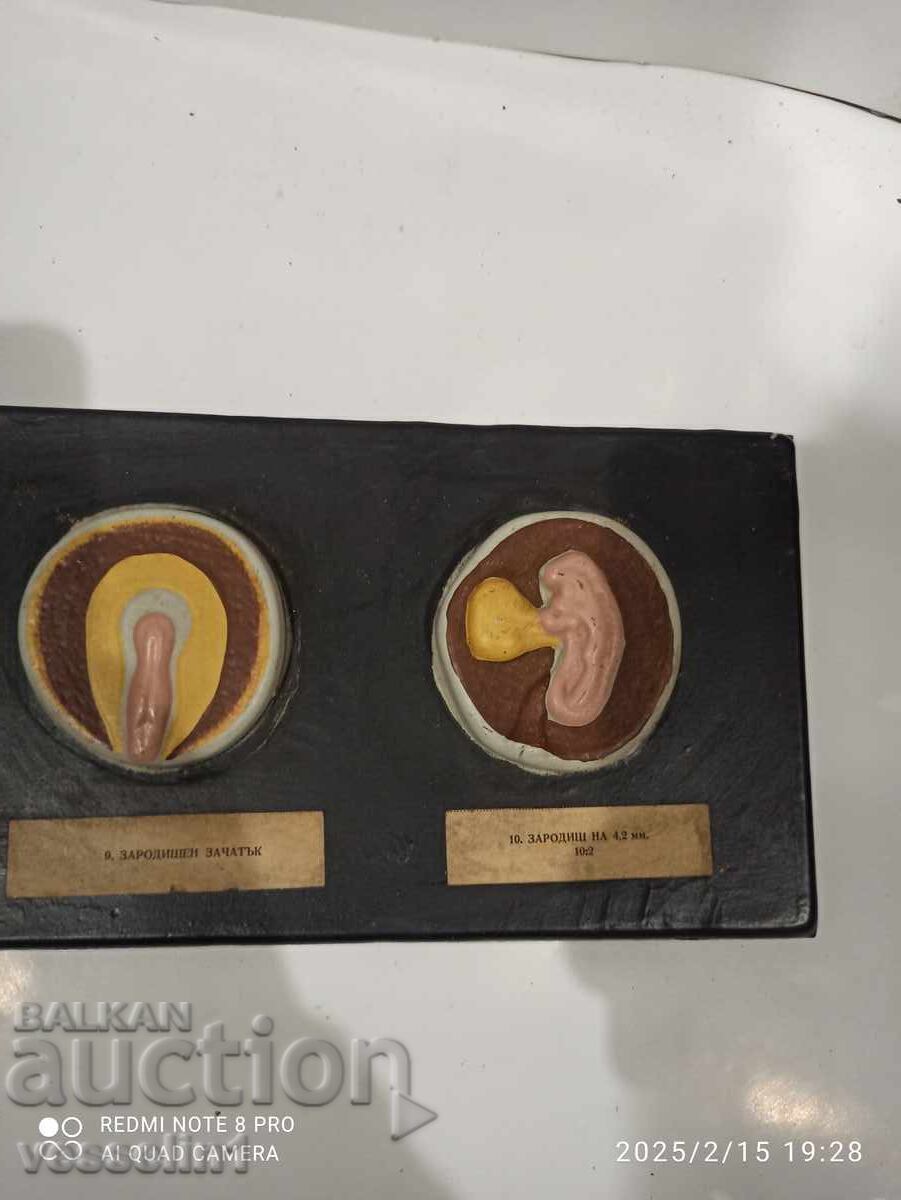 Model of conception, egg cell division, embryonic development Model of conception, egg cell division, embryonic development