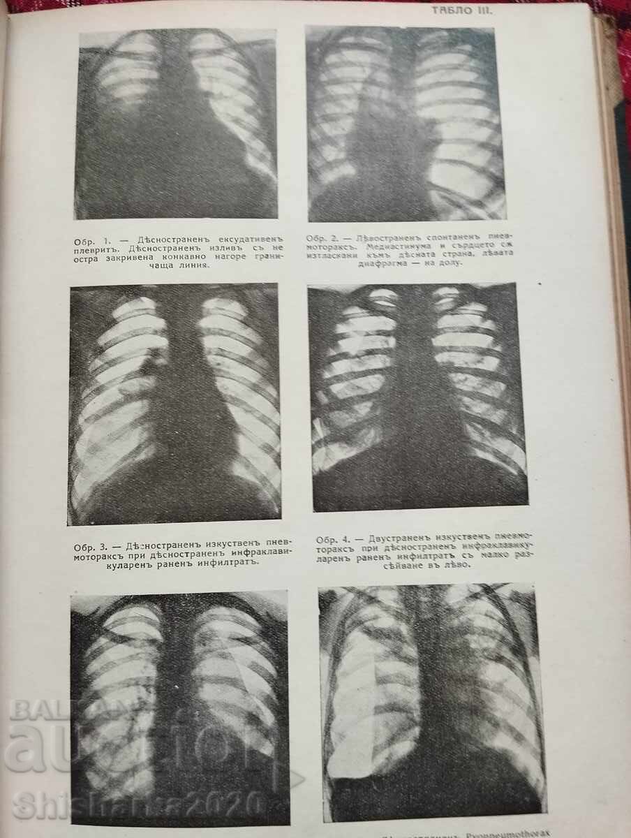 Textbook of special pathology and therapy of internal diseases - 5 Textbook of special pathology and therapy of internal diseases - 5