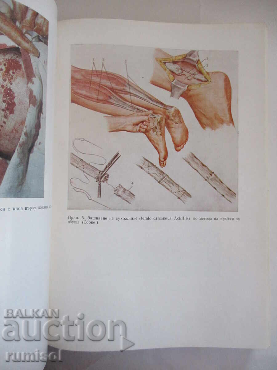 Auction  Surgical Operations with Topographic Anatomy - R. Rainov