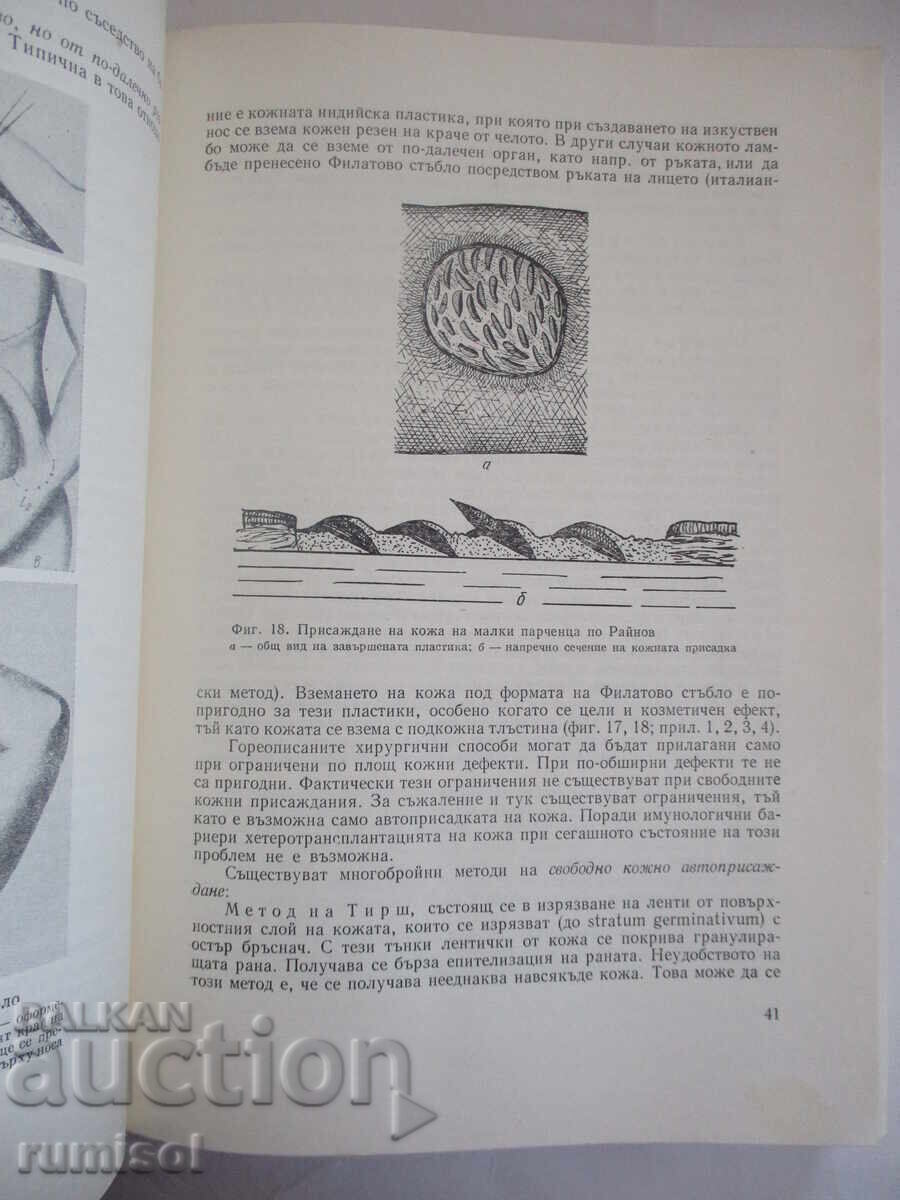 Delivery of Surgical Operations with Topographic Anatomy - R. Rainov