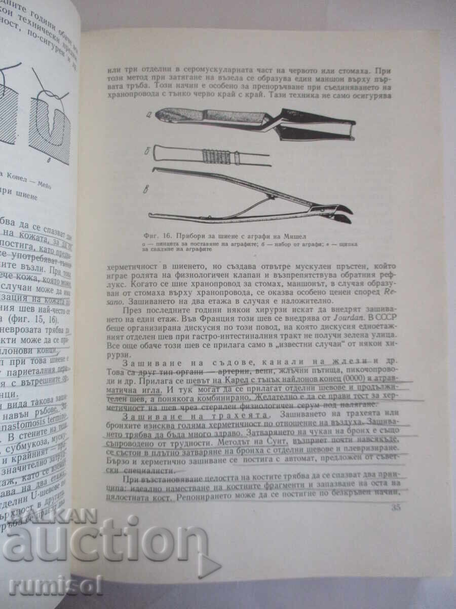 Surgical Operations with Topographic Anatomy - R. Rainov - 5