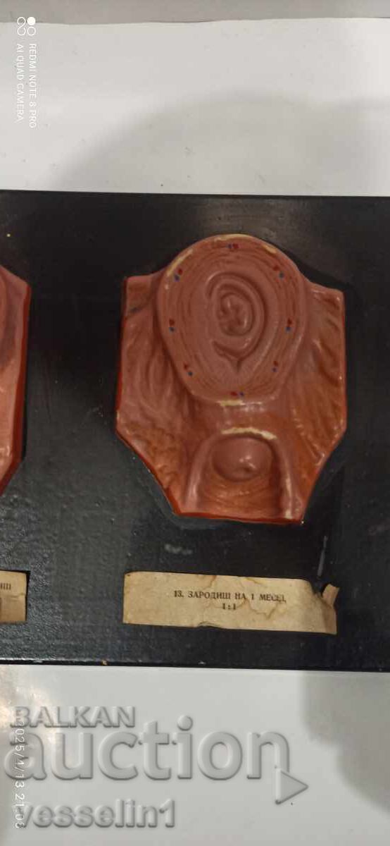 Auction  Model of human embryo. Model development from embryo to fetus