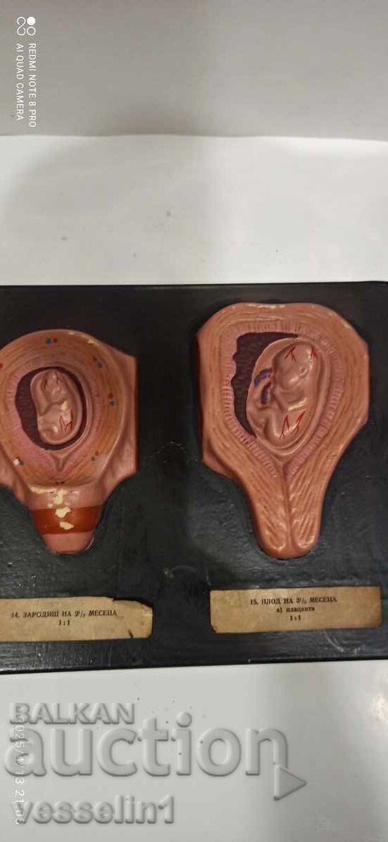 Delivery of Model of human embryo. Model development from embryo to fetus
