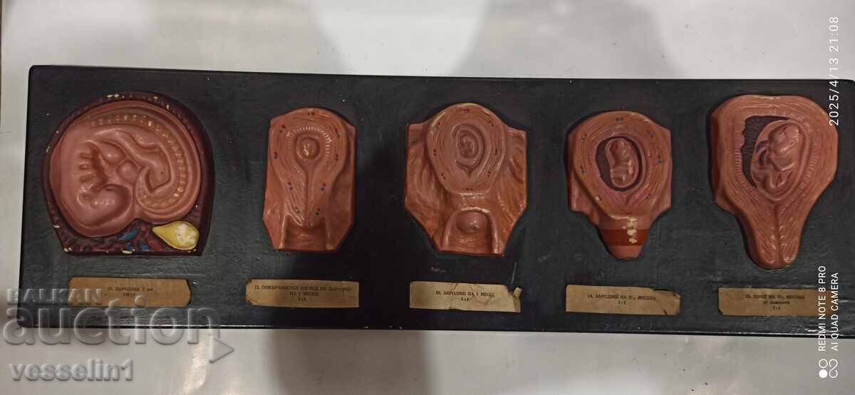 Model of human embryo. Model development from embryo to fetus