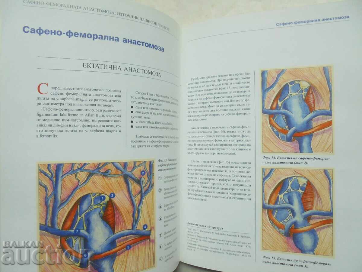 Atlas of the Anatomy of the Superficial Veins of the Lower Limbs - 5 Atlas of the Anatomy of the Superficial Veins of the Lower Limbs - 5