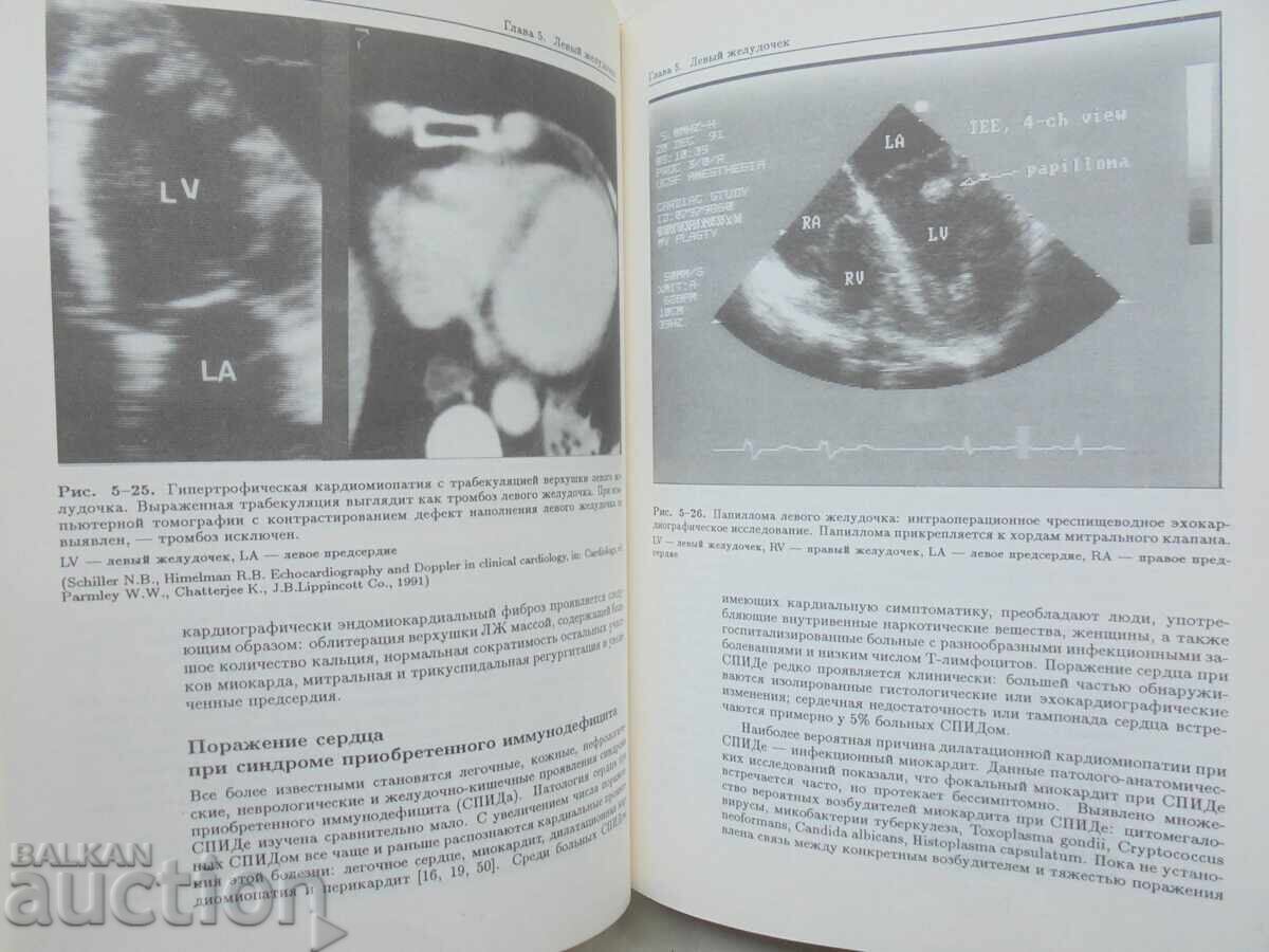 Παράδοση Κλινική ηχοκαρδιογραφία Nelson Schiller Maxim Osipov 1993