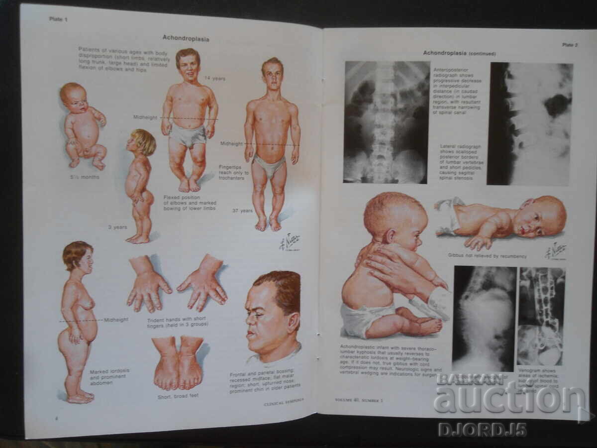 Аукцион CLINICAL SYMPOSIA, Volume 40, Number 1/1988 г.