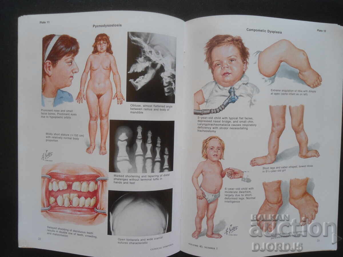 CLINICAL SYMPOSIA, Volume 40, Number 1/1988 г. - 6