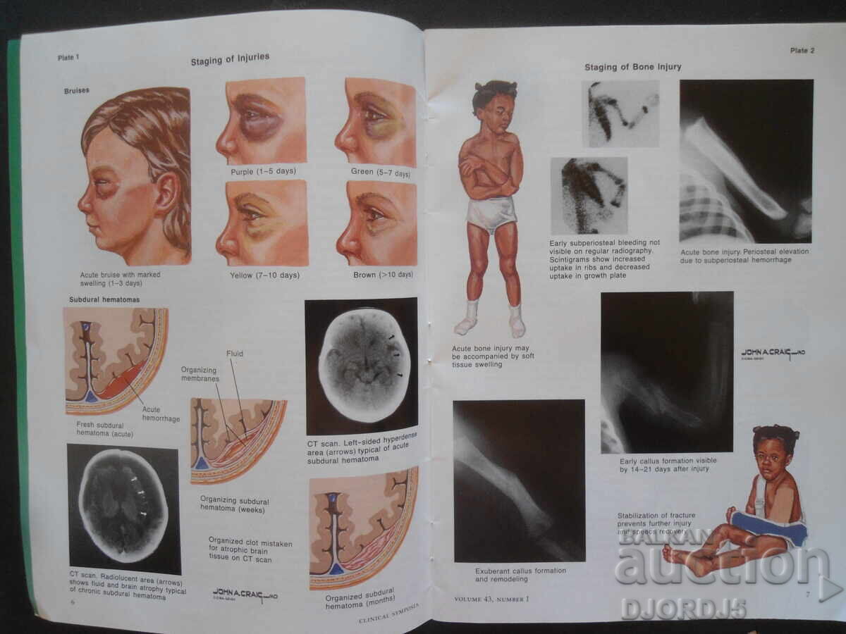 Auction  CLINICAL SYMPOSIA, Volume 43, Number 1/1991