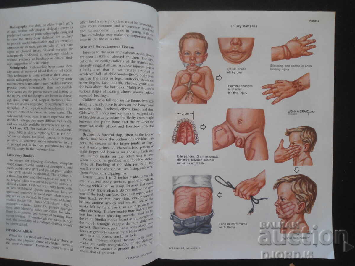 Delivery of CLINICAL SYMPOSIA, Volume 43, Number 1/1991