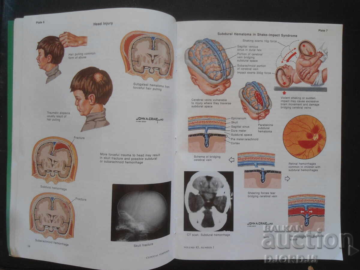 CLINICAL SYMPOSIA, Volume 43, Number 1/1991 - 5