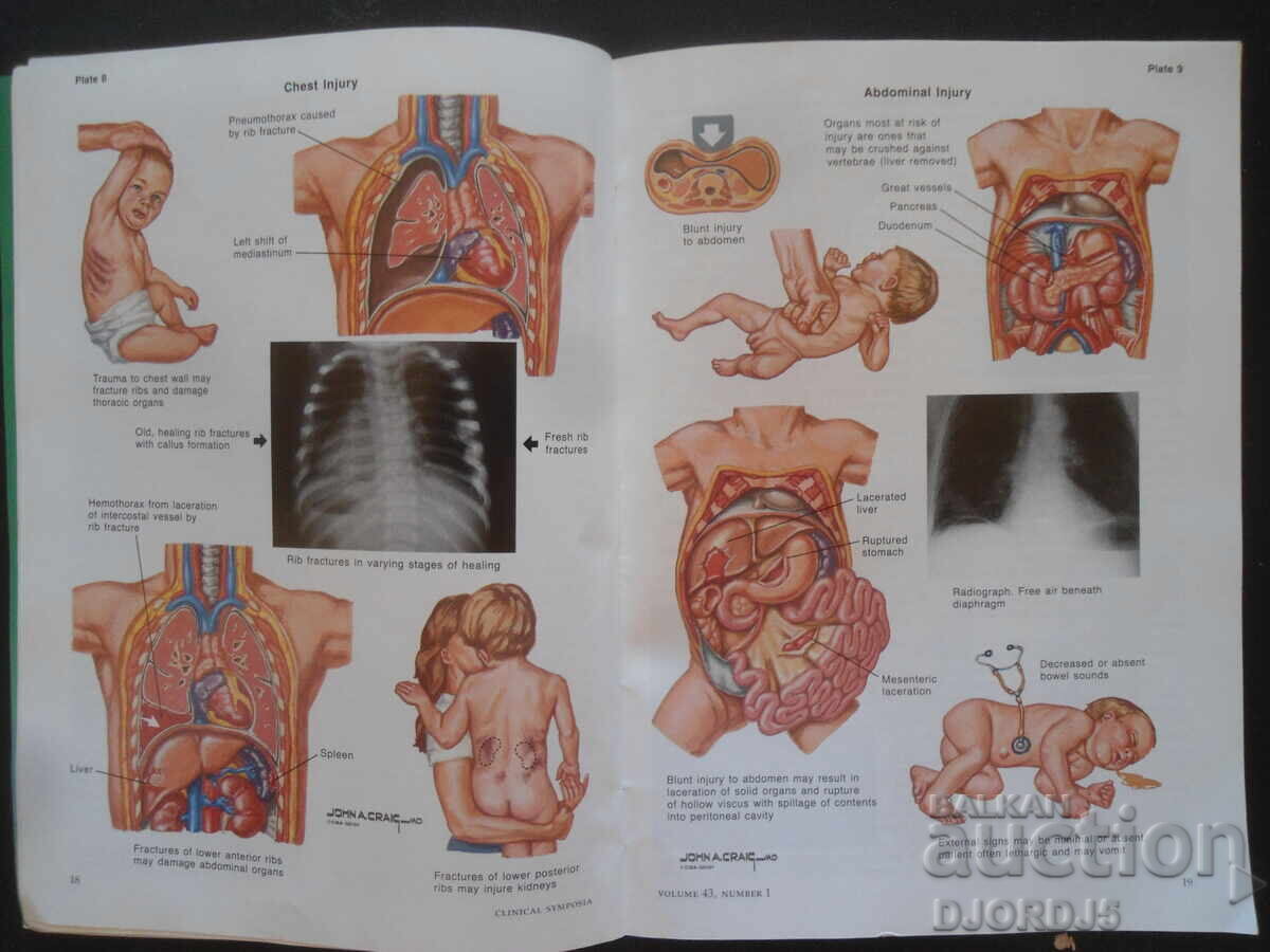 CLINICAL SYMPOSIA, Volume 43, Number 1/1991 - 6