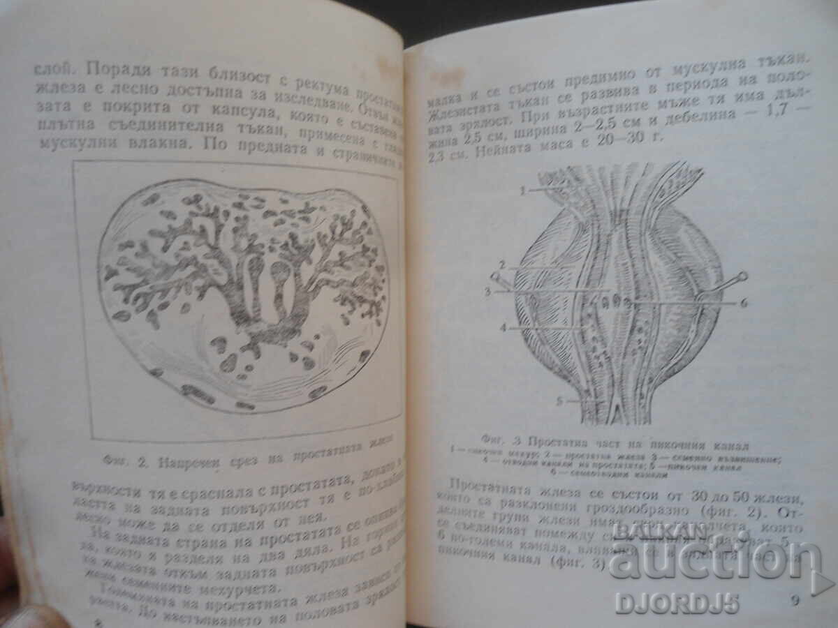 Δημοπρασία Προβλήματα προστάτη, Τοντόρ Πατράσκωφ