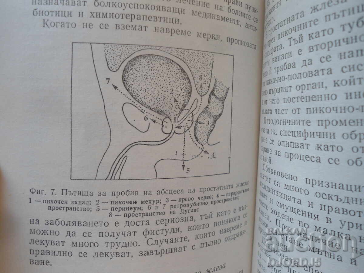 Παράδοση Προβλήματα προστάτη, Τοντόρ Πατράσκωφ