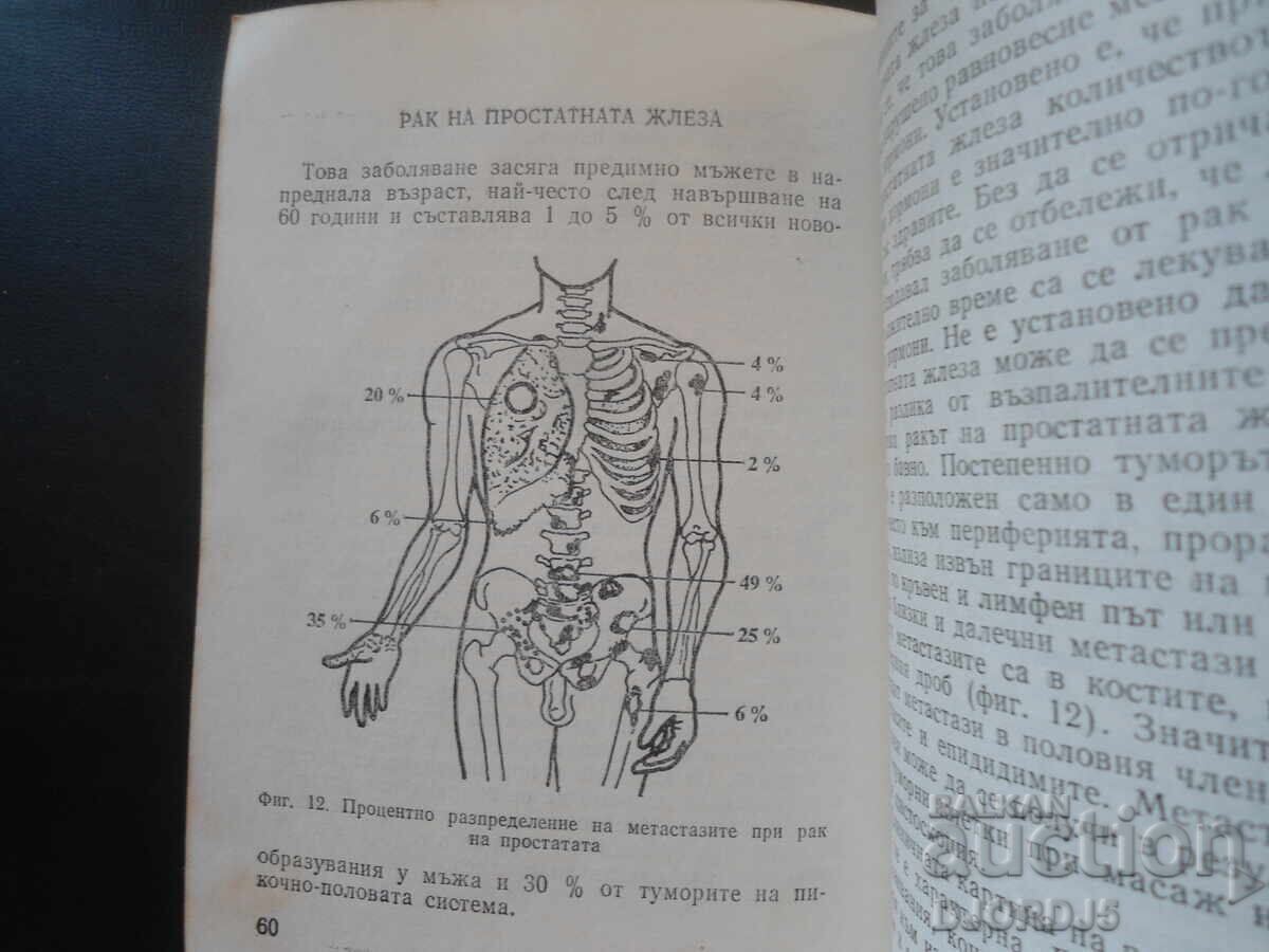 Προβλήματα προστάτη, Τοντόρ Πατράσκωφ - 5