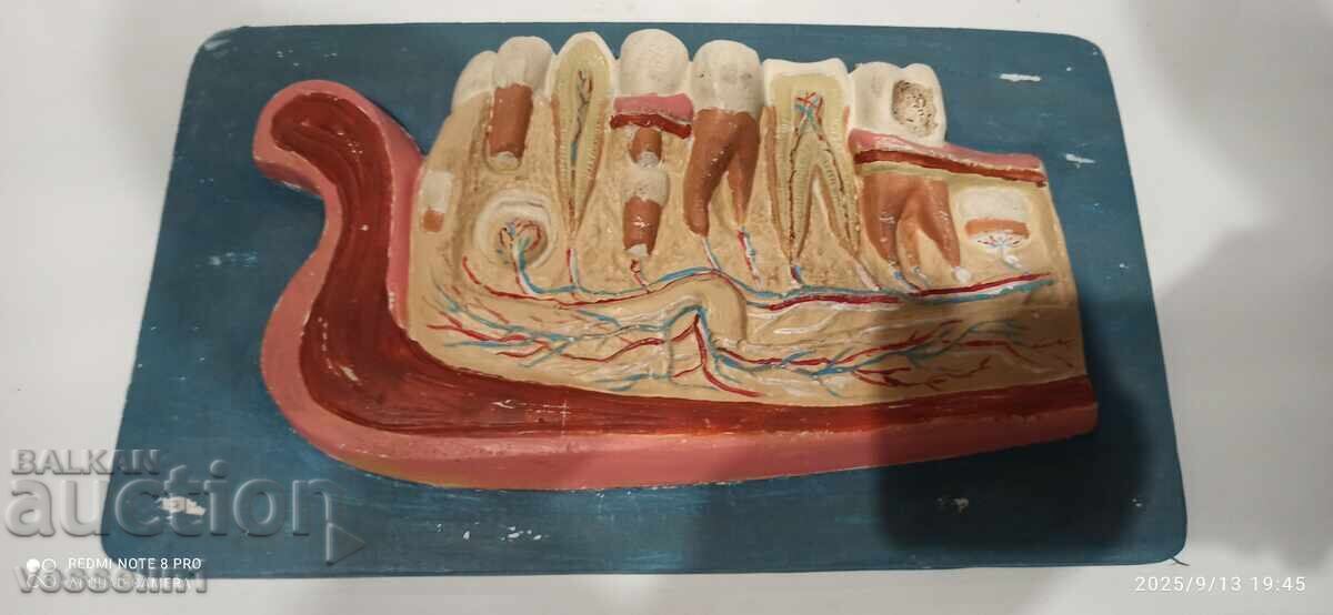 Old educational model of teeth jaw, social with price 168.00 BGN | € 85.90 Old educational model of teeth jaw, social with price 168.00 BGN | € 85.90