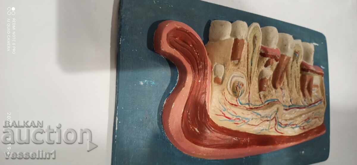 Auction Old educational model of teeth jaw, social Auction Old educational model of teeth jaw, social