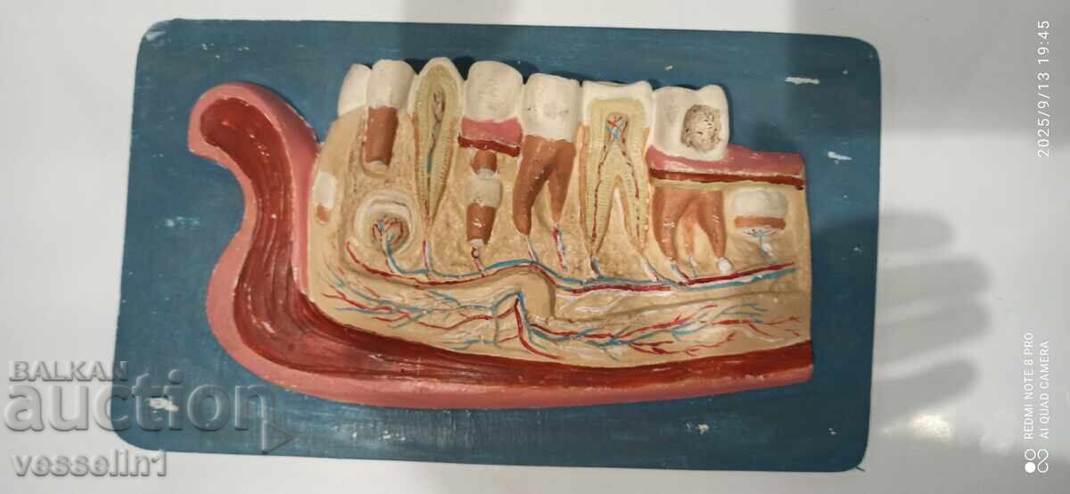 Old educational model of teeth jaw, social Old educational model of teeth jaw, social