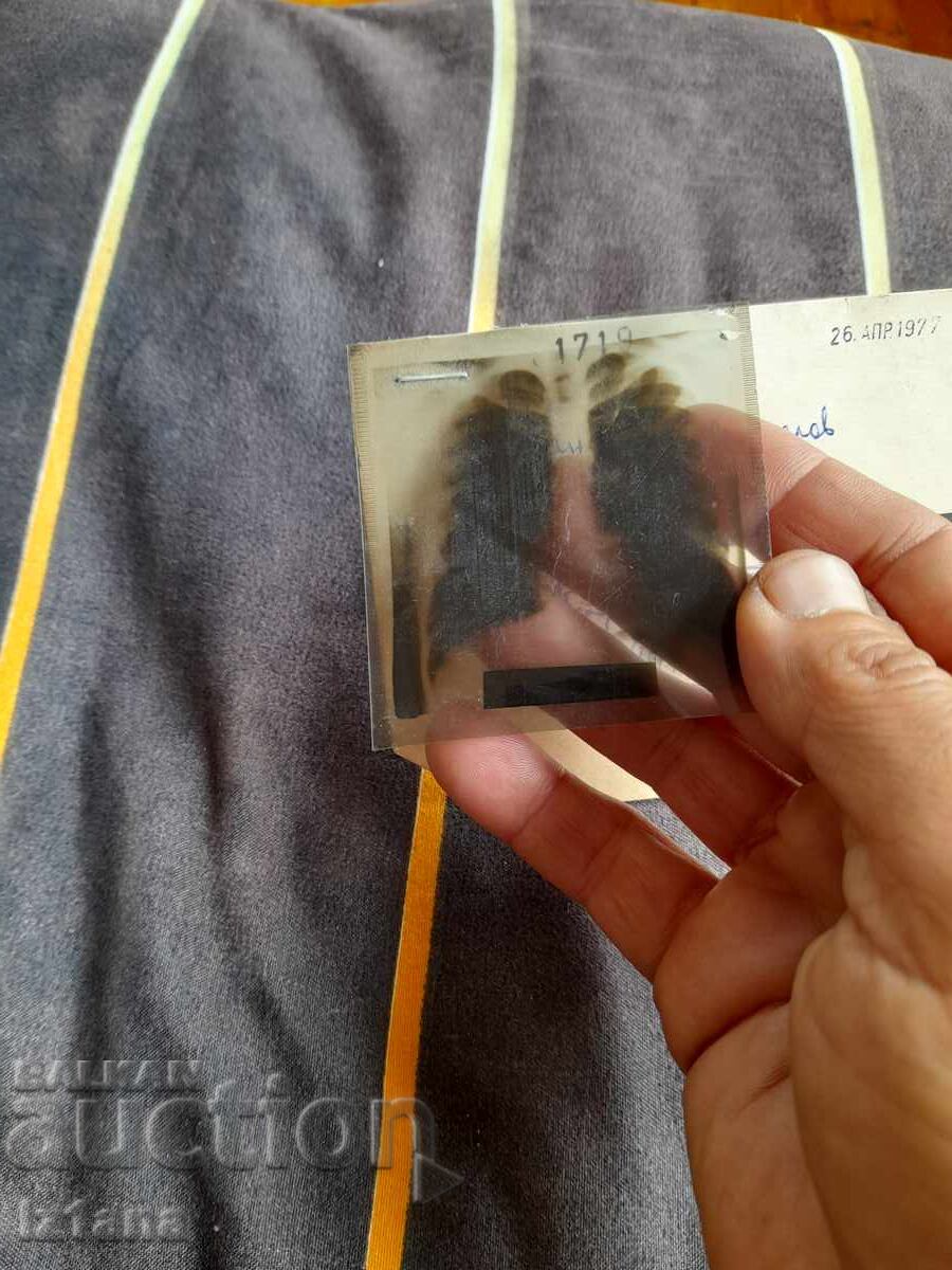 Παλιά ακτινογραφία 1977 με τιμή 16.00 BGN | € 8.18