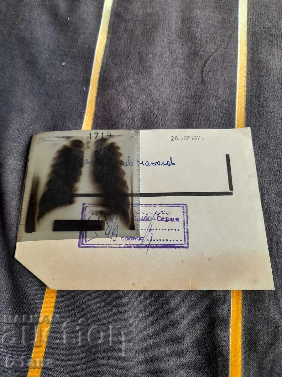 Παλιά ακτινογραφία 1977