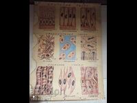 Placă veche, tablă de învățământ, țesături în corpul uman