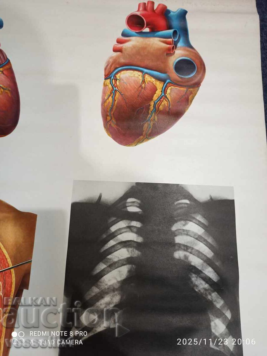 Licitație Vechi panou didactic de la Deutsches Hygiene-Museum, secțiune transversală a inimii Licitație Vechi panou didactic de la Deutsches Hygiene-Museum, secțiune transversală a inimii