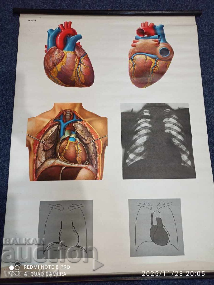 Vechi panou didactic de la Deutsches Hygiene-Museum, secțiune transversală a inimii Vechi panou didactic de la Deutsches Hygiene-Museum, secțiune transversală a inimii