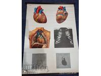 Vechi panou didactic de la Deutsches Hygiene-Museum, secțiune transversală a inimii