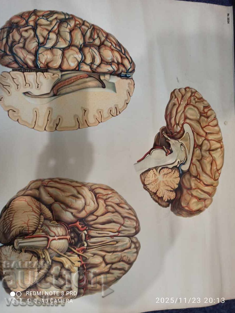 Veche planșă educațională de la Deutsches Hygiene-Museum, secțiune creier cu preț € 45.00 | 88.01 BGN