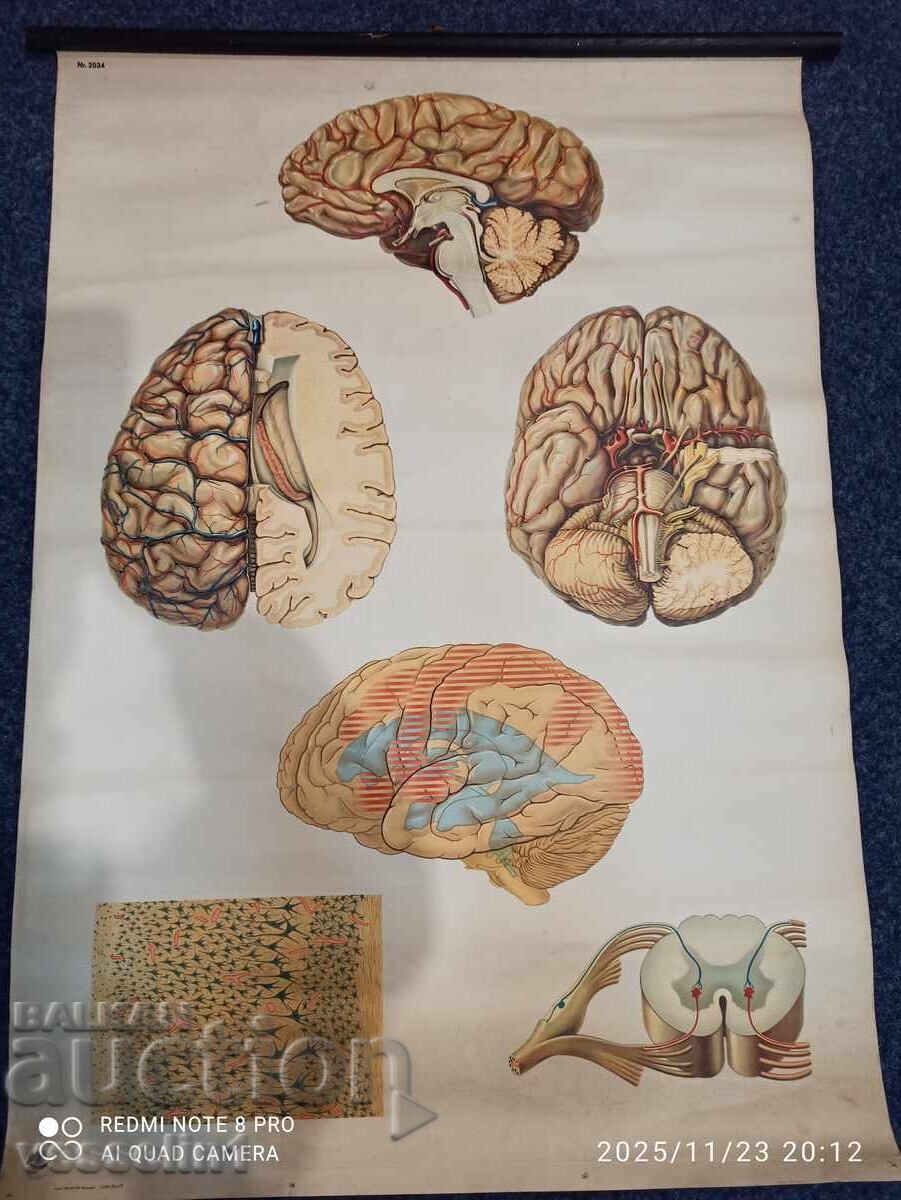 Veche planșă educațională de la Deutsches Hygiene-Museum, secțiune creier