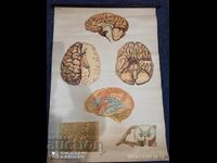 Veche planșă educațională de la Deutsches Hygiene-Museum, secțiune creier