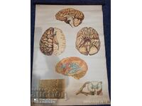 Veche planșă educațională de la Deutsches Hygiene-Museum, secțiune creier