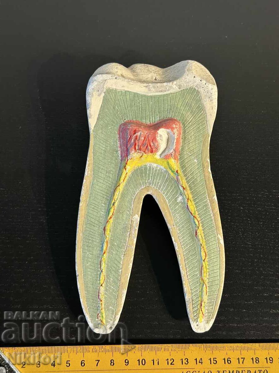 Соц Учебен Модел на Човешки Зъб Разрез с цена € 52.00 | 101.70 лв.