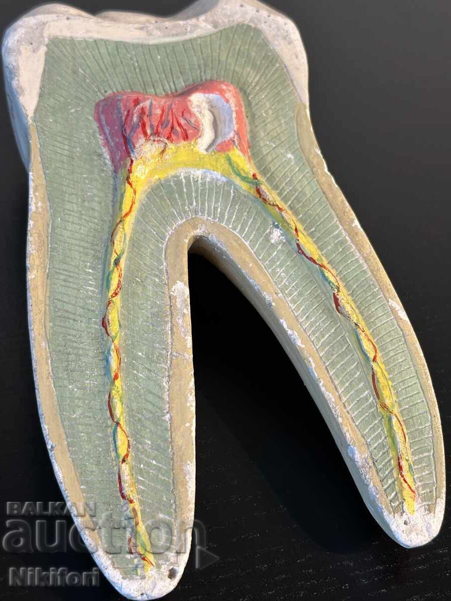 Παράδοση Sotsialen Ucheben Model na Choveshki Zŭb Razrez