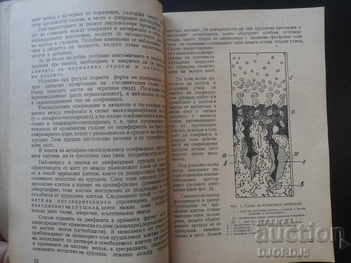 Δημοπρασία RAKHIT, Klinika, profilaktika i lechenie Δημοπρασία RAKHIT, Klinika, profilaktika i lechenie