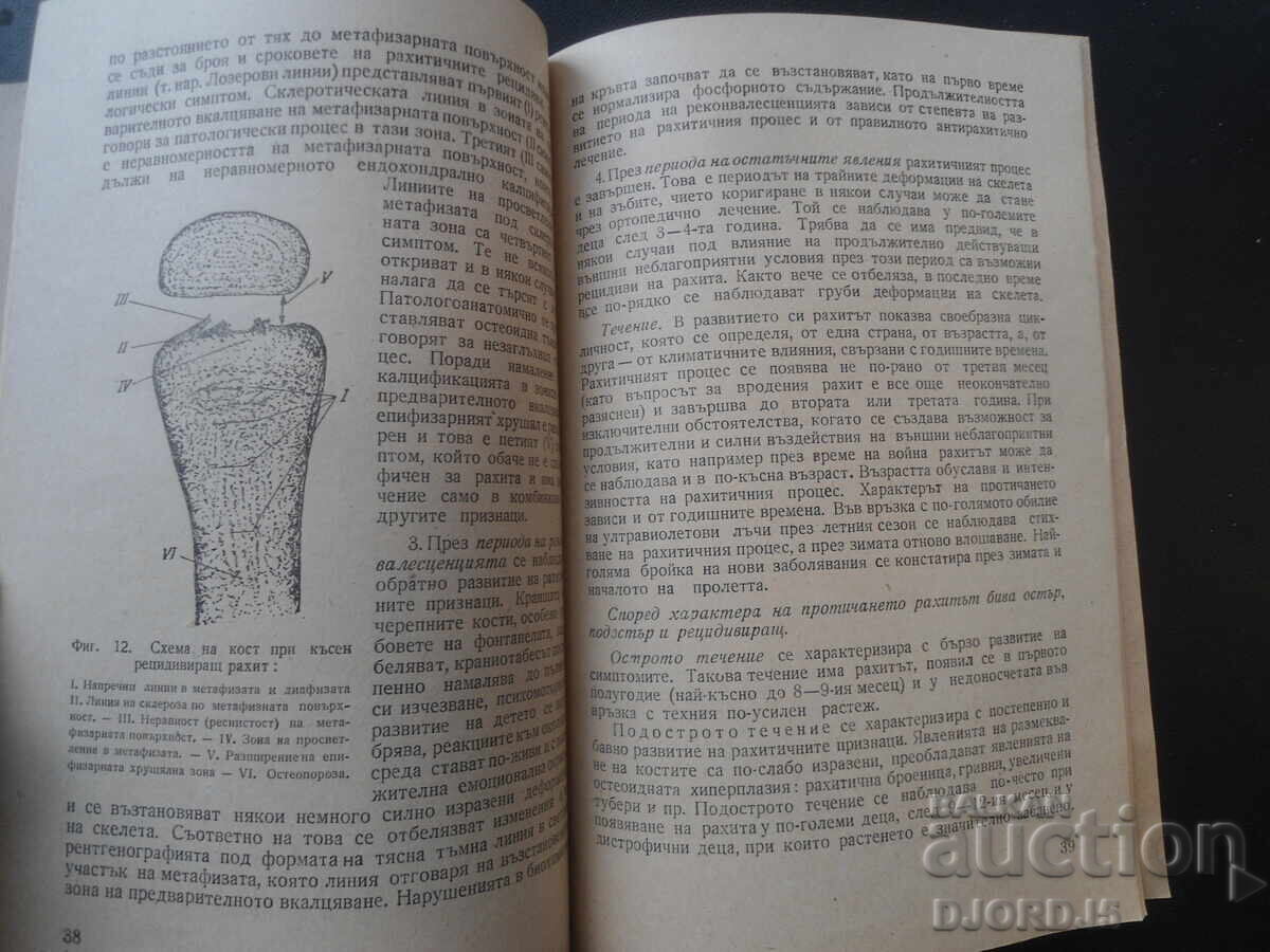 Παράδοση RAKHIT, Klinika, profilaktika i lechenie Παράδοση RAKHIT, Klinika, profilaktika i lechenie