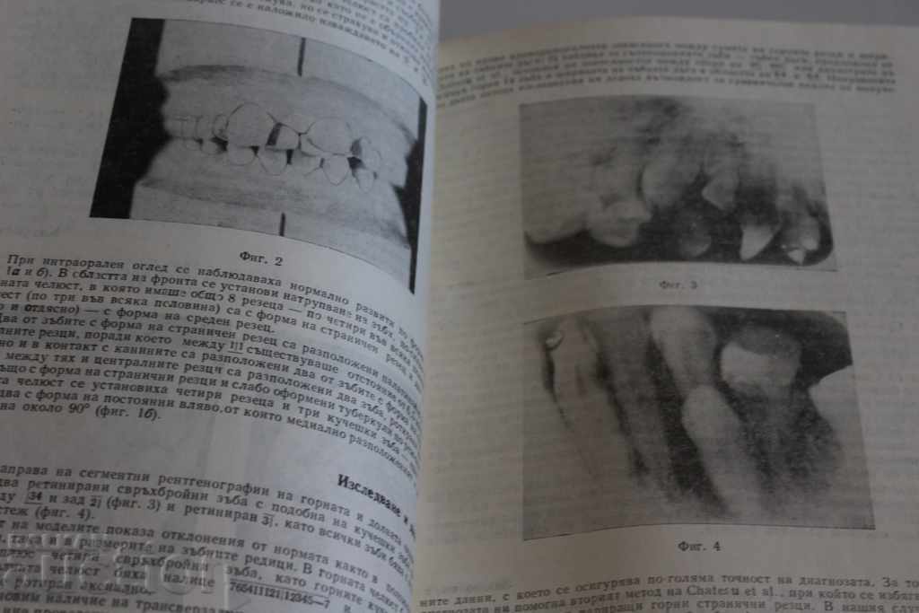REVISTĂ STOMATOLOGIE 1975 STOMATOLOG STOMATOLOGIC STOMATOLOG - 5 REVISTĂ STOMATOLOGIE 1975 STOMATOLOG STOMATOLOGIC STOMATOLOG - 5